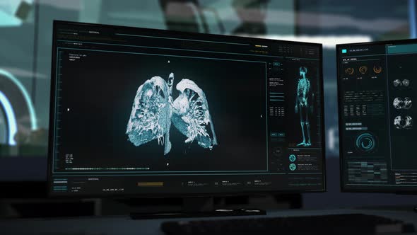 Diagnostic scanner interface has detected the lung cancer cells in a sick person alt