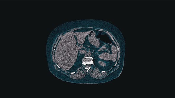 Voluminous Color MRI of the Abdominal Cavity, Gastrointestinal Tract, Bladder