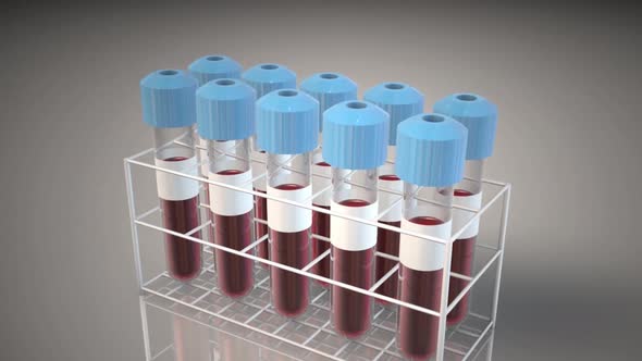Laboratory testing blood of patients to COVID-19. alt
