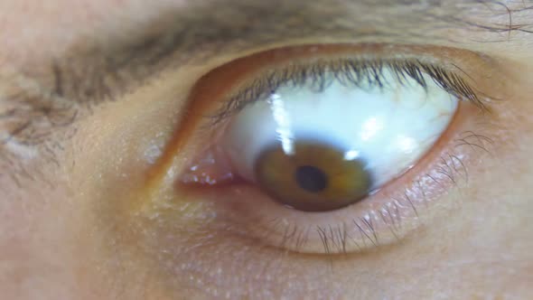 Crazy and Fear Look of Human Eye. Slow Motion