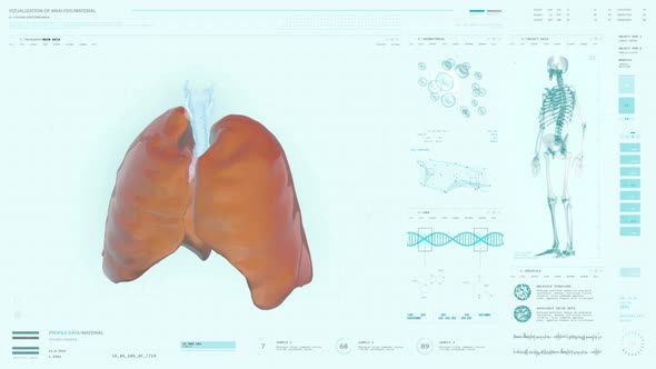 X-Ray Examination Interface Analyzing Patients Lungs To Assign Treatment alt