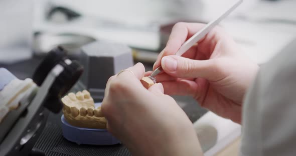 A female dentist technologist holds a mock-up of a jaw in her hands. Making dentures