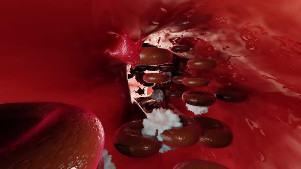 Red blood cells flow inside an artery, Healthy blood flow