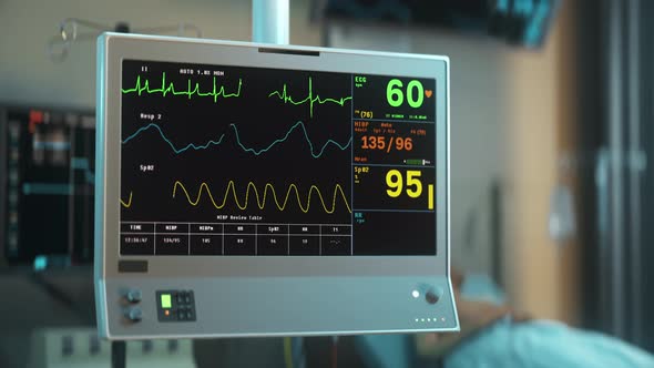 Electronic monitoring system detects a rapid decrease in the patients pulse