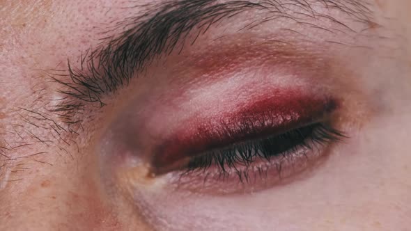 Bruise Over the Eye of a Man Closeup