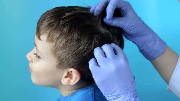 The pediatrician in the gloves will check the presence of lice and nits in a small child