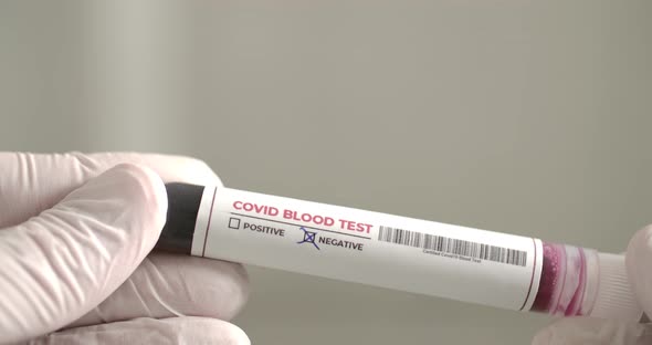 Blood Test for Covid