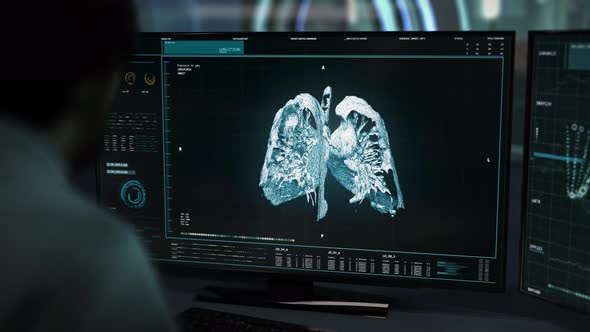 Doctor Exams Lung Cancer Disease Diagnosis In A Futuristic Medical Laboratory alt