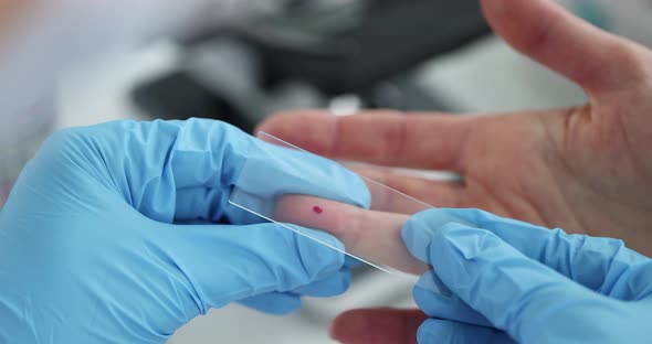 Doctor Taking Blood From Finger Using Glass Slide Closeup  Movie Slow Motion