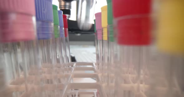 Chemist Hand Taking Out Test Tubes with Liquid in Laboratory Closeup  Movie