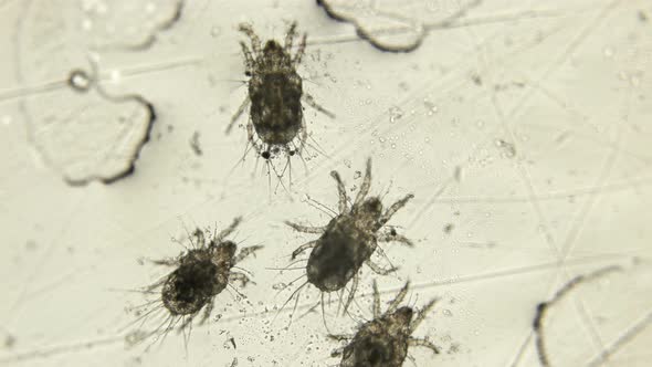 Barn or Flour Mite Under a Microscope