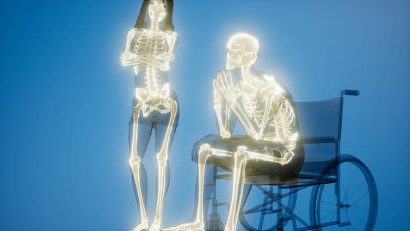 Man in Wheelchair with Visible Bones alt