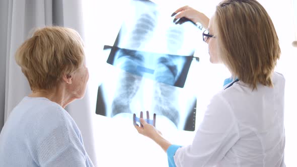 Healthcare, Medical Concept. Doctor Showing Xray To An Elderly Patient.