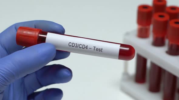 CD3 CD4-Test, Doctor Holding Blood Sample in Tube Close-Up, Health Check-Up
