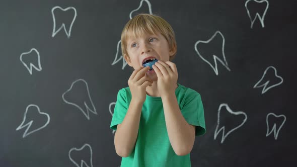 Little Boy Shows His Dental Trainer. Silicon Burl for the Formation of the Correct Bite in Children