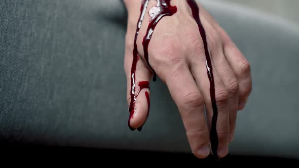 Blood Drips From the Hand of the Murdered Man