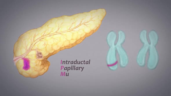 visualization of pancreatic cancer cells.