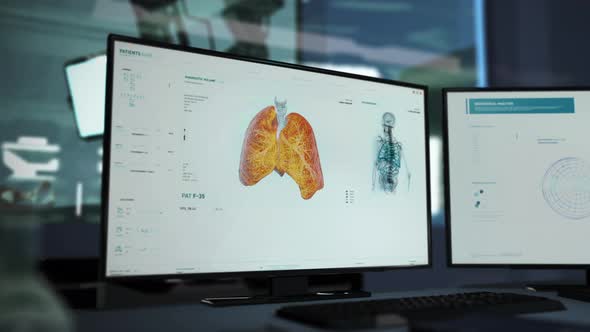 Medical Software is Performing a scanning of the Lung and Finding Covid-19 virus alt