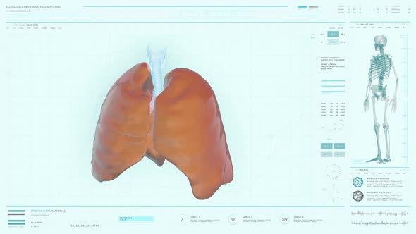 Digital Visualization Of Futuristic Laboratory Scan Of Covid-19 Affected Lungs alt