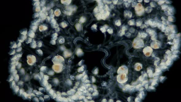 Infusoria (Ciliophora) Peritrichia under microscope, order Sessilida, class Oligohymenophorea