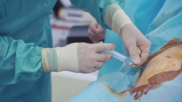 Stem cell injection procedure. Male's hands in gloves with syringe.