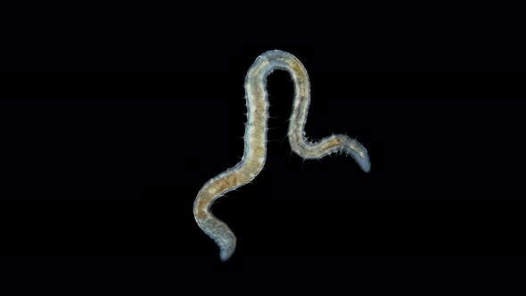 Worm Nais sp. under a microscope, Family Naididae, a class of Oligochaeta