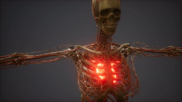 CG Animation Of A Sick Human Heart