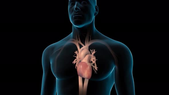 Carotid Artery Disease 3D Medical Animation alt