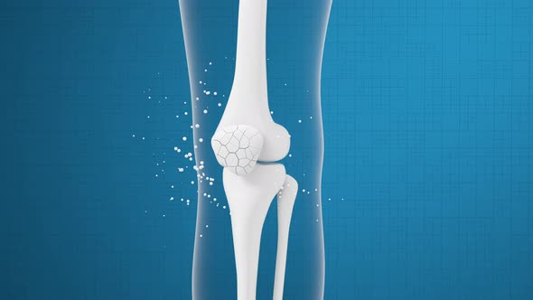 Leg bone and knee healing