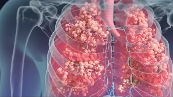 Respiratory system Alveoli 3d anatomy