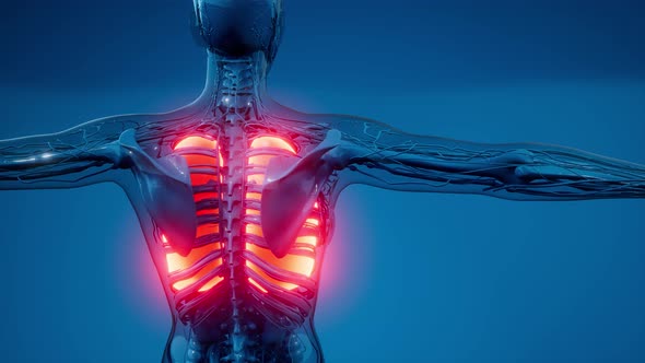 Human Lungs Radiology Exam alt