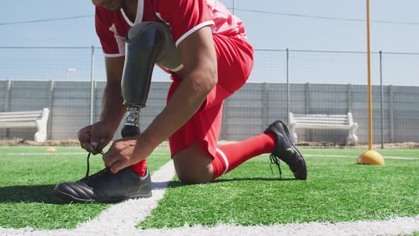 Soccer player with prosthetic leg on field