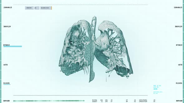 Futuristic Medical Computer Analysis System Interface Scanning Patients Lungs alt