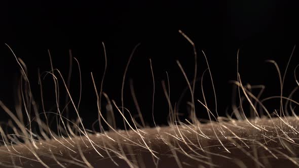 Slow Motion Macro of Hair Raising Goose Bumps on Man Arm Skin Caused By Some Strong Emotions.