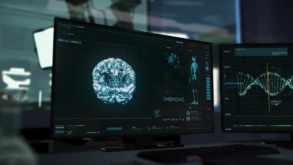 Digital X-ray Diagnostic Software Interface Scans Patients Brain Organ alt