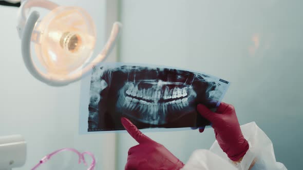 The Dentist Examines a Panoramic Xray of the Teeth