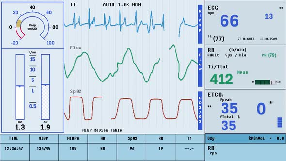 Modern Hospital equipment is displaying the lung condition of the sick patient