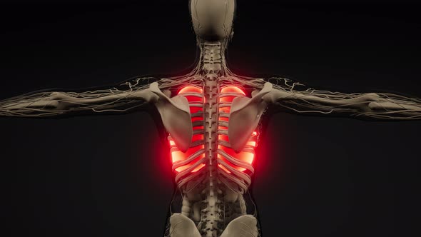 Human Lungs Radiology Exam alt