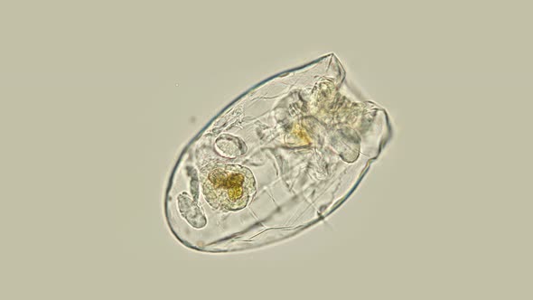 Rotifer Under the Microscope Asplanchna Priodonta, Family Asplanchnidae, Genus Asplanchna