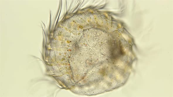 Part of Ctenophora with Cilia Under a Microscope. For a While It Still Moves and Contracts, Very