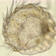 Part of Ctenophora with Cilia Under a Microscope. For a While It Still Moves and Contracts, Very - VideoHive Item for Sale