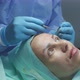 Plastic surgery for eyebrow correction - VideoHive Item for Sale