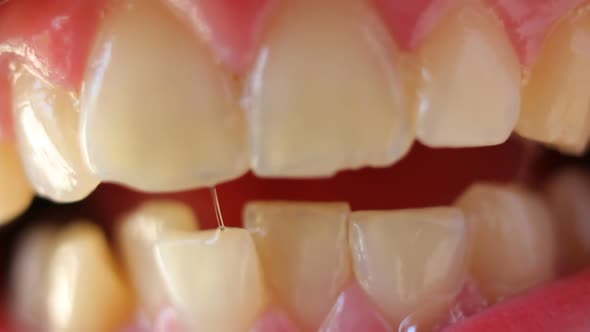 A Close-up of Crooked Teeth