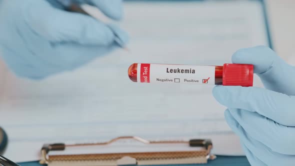 The Doctor Holds Hand Blood Sample Tube for Leukemia Cells Test