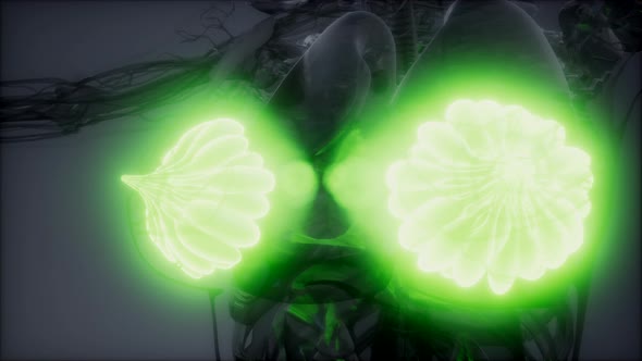 Medically Accurate Illustration of an Obese Womens Mammary Glands alt