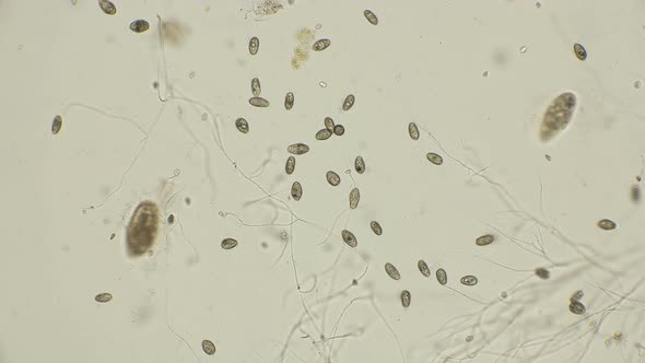 Dead Colony of the Ciliates of the Coleps, Which Are Largely in Dirty Water, After Being Treated