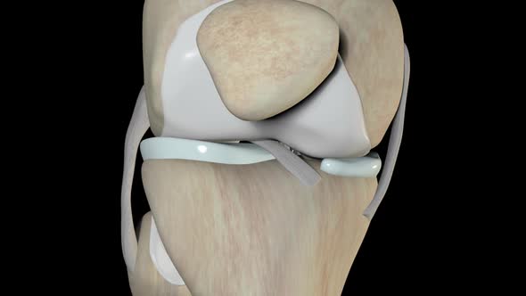 Knee Injuries   The Anterior Cruciate Ligament Rupture