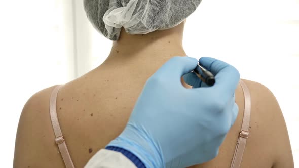 Dermatologist Examines the Patient's Moles and Marks the Ones to Be Removed