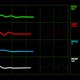 Icu Heart Rate Monitor Going Flat - VideoHive Item for Sale