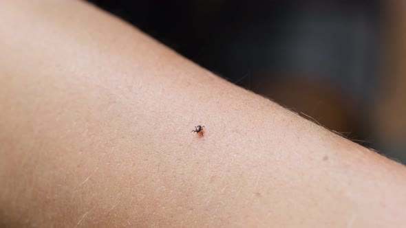 Tick Crawling on the Human Hand Close Up